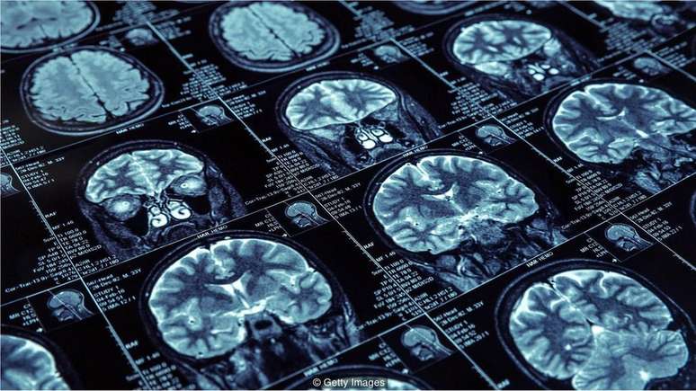 Durante o sono de ondas lentas, o hipocampo e o neoc&oacute;rtex se comunicam para codificar informa&ccedil;&otilde;es na mem&oacute;ria de longo prazo