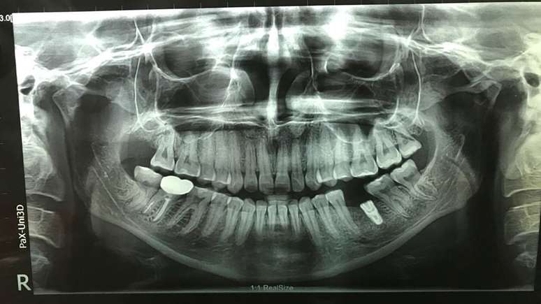 Um raio-X dos dentes de Lizzie Porter