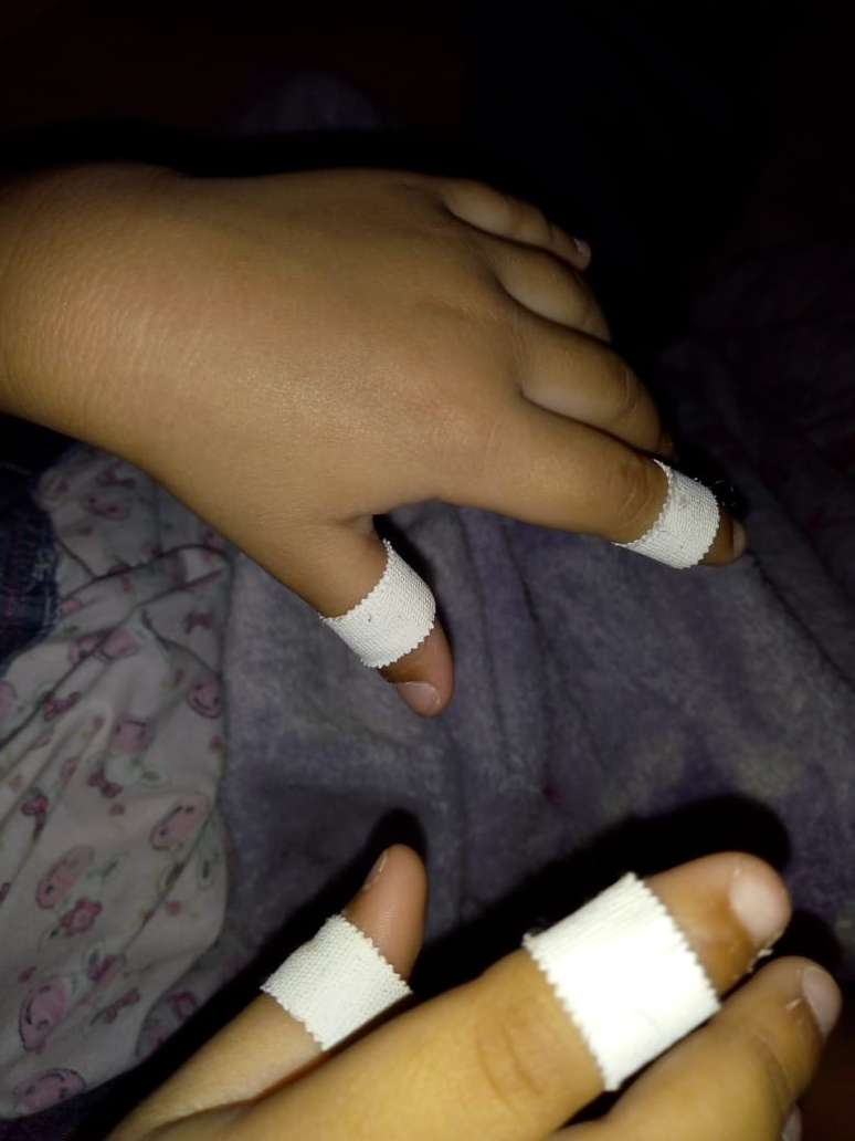 Colocar esparadrapo nos dedos é uma das técnicas usadas no tratamento