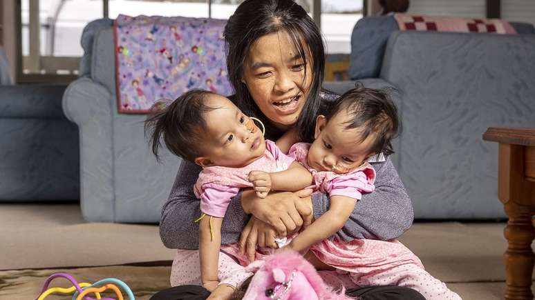 Com ajuda de instituição de caridade, mãe e filhas foram do Butão à Austrália para fazer cirurgia