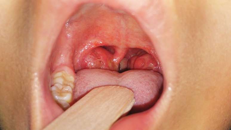 Estudos mostram que, em v&aacute;rios pa&iacute;ses, essas cirurgias s&atilde;o realizadas sem justificativa cl&iacute;nica