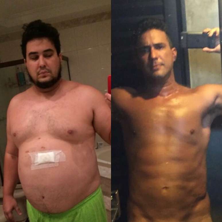 André Marques mostrou o antes e o depois da cirurgia bariátrica