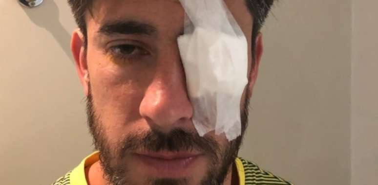 Pablo Perez sofreu ferimentos no olho após ataque; imagem foi divulgada pelo médico do Boca Juniors