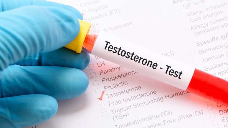 Homens com Klinefelter precisam receber doses de testosterona