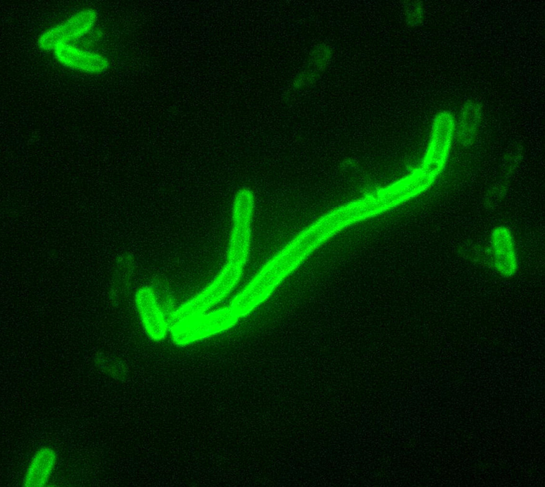 A doença é causada pela bactéria Yersinia pestis, transmitida por meio de pulgas de ratos.