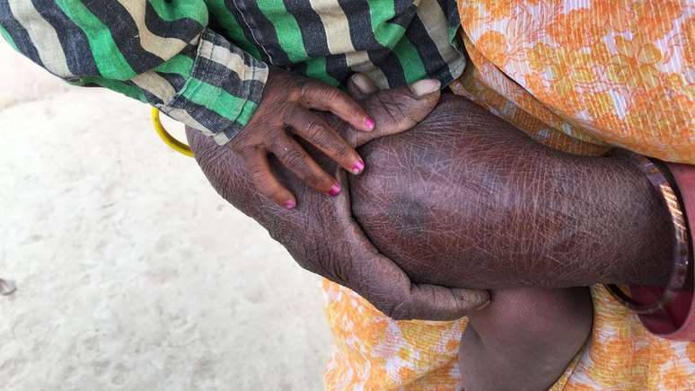 Khazanchi aparece com as unhas pintadas de rosa