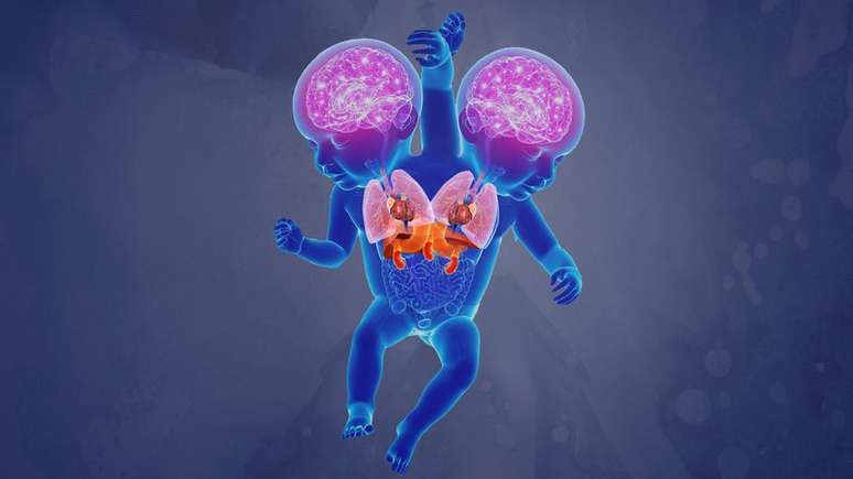 As crian&ccedil;as t&ecirc;m c&eacute;rebros, pulm&otilde;es e cora&ccedil;&otilde;es pr&oacute;prios