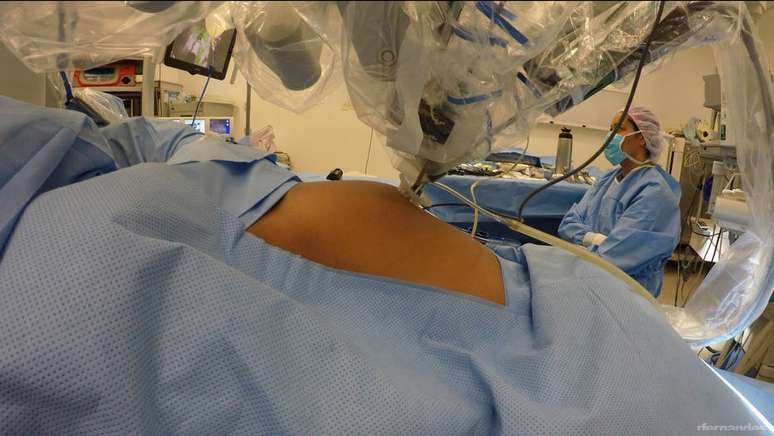 Robô usado em cirurgia de remoção de tumor no colo do útero