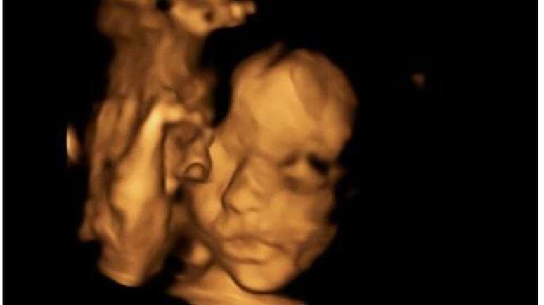 O nascimento da filha de Bethan e Keiron Simpson, Eloise, está previsto para abril