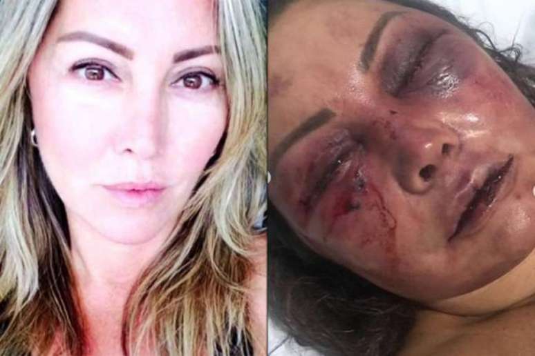 Mãe do lutador Rayron Gracie foi torturada na manhã de domingo, em seu apartamento no Rio (Foto: Reprodução)
