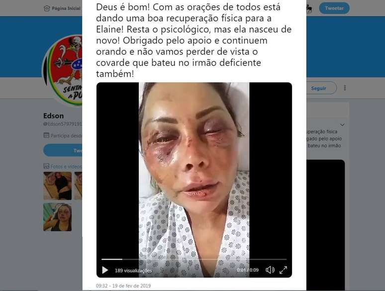 Empresária aparece com o rosto inchado e ferido em vídeo postado no Twitter
