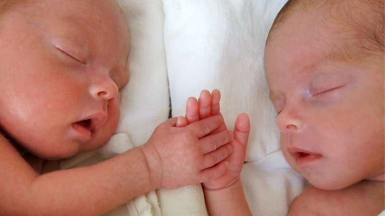 Especialistas explicam que o raro fenômeno "feto in fetus" acontece quando o óvulo fecundado se divide depois da segunda semana e não na primeira, como acontece no caso de gêmeos idênticos