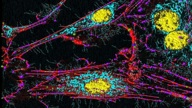 A an&aacute;lise mitocondrial com amostras de descendentes vivos de uma das v&iacute;timas e do principal suspeito &agrave; &eacute;poca refor&ccedil;ou a tese da pol&iacute;cia