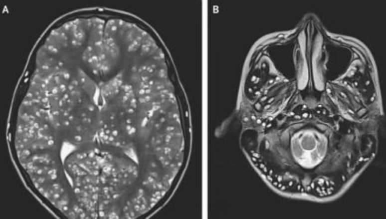 Foto: Reprodução/New England Journal Of Medicine