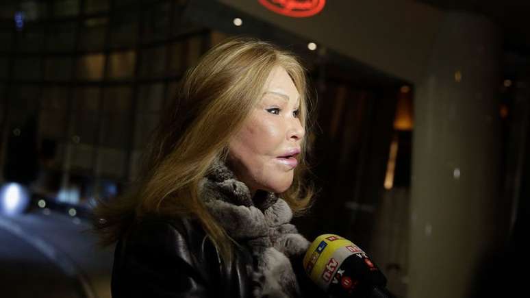 Jocelyn Wildenstein ganhou apelido de 'mulher-gato' devido à aparência que seu rosto tomou por causa de seguidas cirurgias plásticas