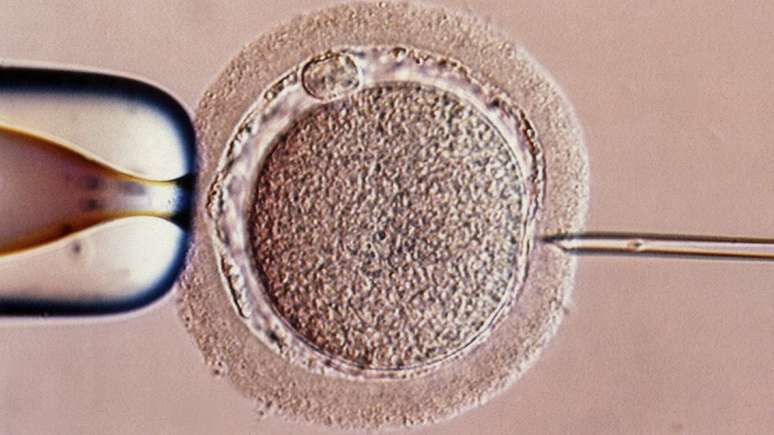 O bebê foi gerado usando uma forma experimental de fertilização in vitro