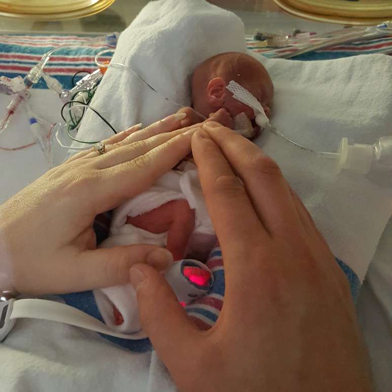 Connor nasceu após 26 semanas de gestação, pesando apenas 310 gramas