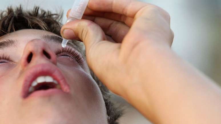 Uso de col&iacute;rio sem acompanhamento m&eacute;dico pode ampliar chance de glaucoma