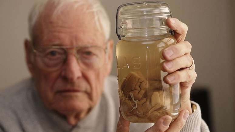 Thomas Harvey, respons&aacute;vel pela aut&oacute;psia de Einstein, guardou amostras do c&eacute;rebro do f&iacute;sico