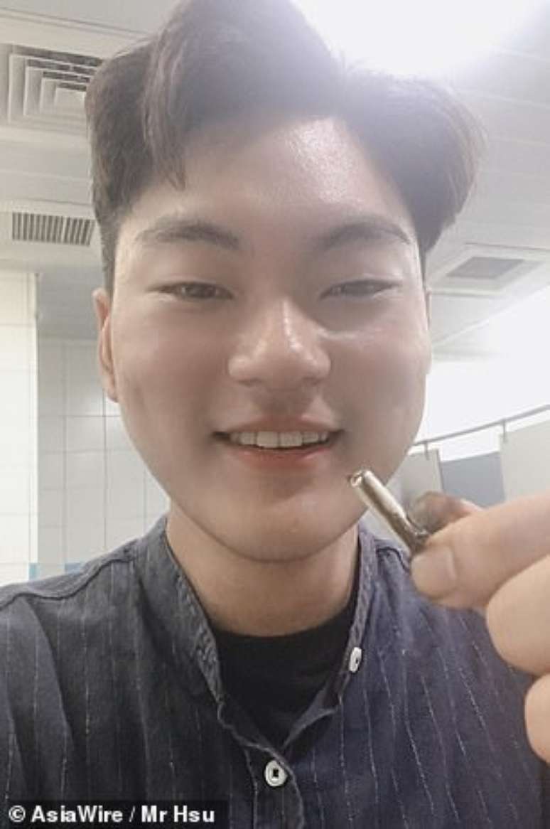 Ben Hsu mostra o fone da Apple que atravessou seu sistema digestivo (fonte: AsiaWire/Daily Mail)