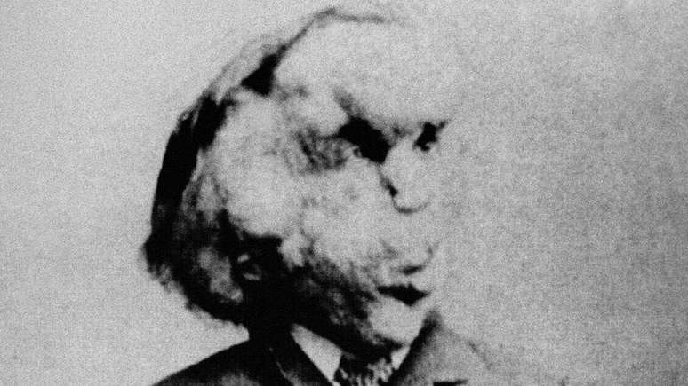 Joseph Merrick surpreendeu médicos com sua natureza inteligente e sensível