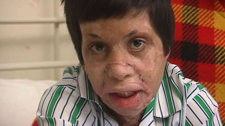 Amar passou a inf&acirc;ncia sendo submetido a tratamentos m&eacute;dicos no Reino Unido e teve dificuldades de adapta&ccedil;&atilde;o