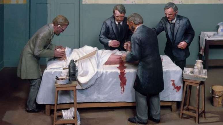 Parar o sangramento foi o primeiro grande desafio dos cirurgi&otilde;es para reduzir o n&uacute;mero de mortes em opera&ccedil;&otilde;es