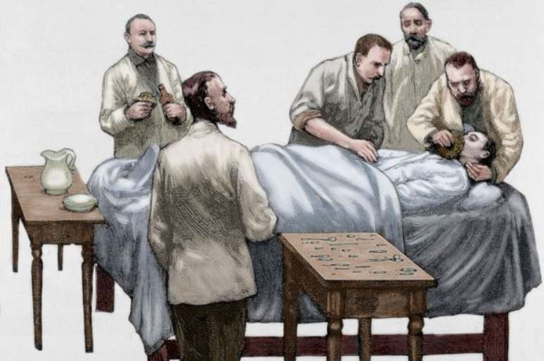 O clorof&oacute;rmio come&ccedil;ou a ser usado nas opera&ccedil;&otilde;es no final do s&eacute;culo 19