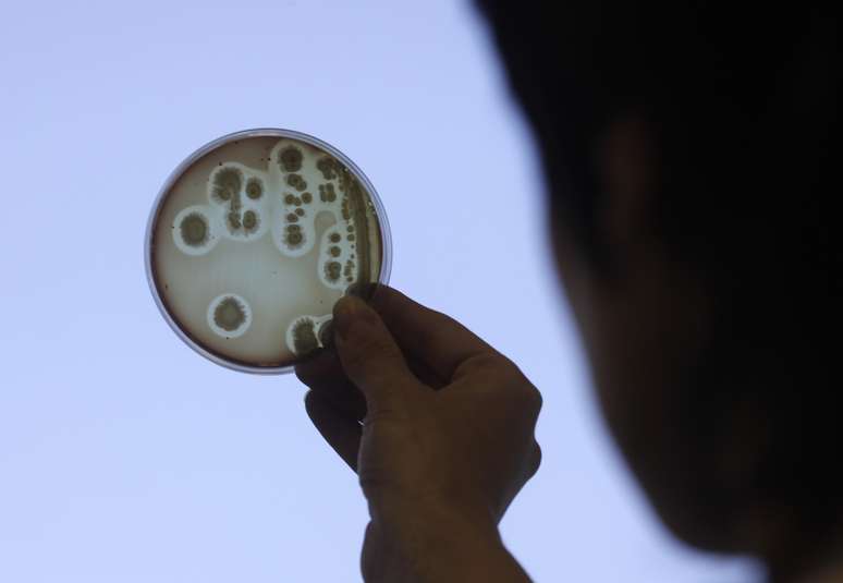 Cientista maneja cultura de Escherichia coli