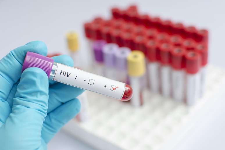 No Brasil, estima-se que 866 mil pessoas vivem com HIV