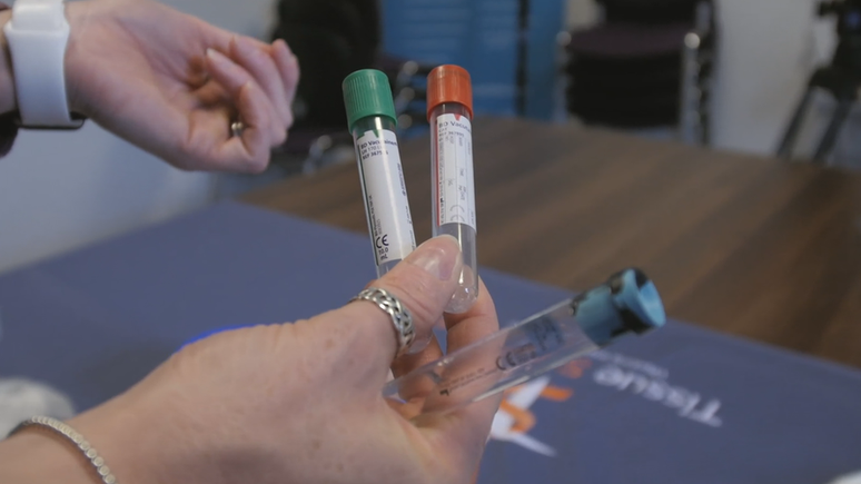 Pessoas com psor&iacute;ase (uma doen&ccedil;a de pele) costumam ser doadoras de pele com boa vontade, j&aacute; que suas amostras podem levar a novos tratamentos.