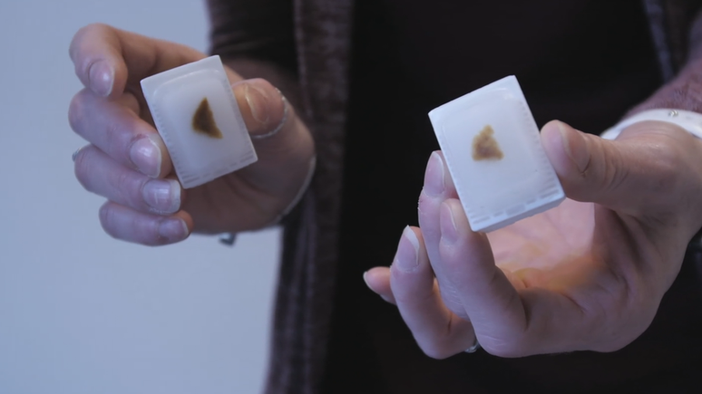 Amostras de f&iacute;gado tamb&eacute;m podem ser solicitadas por pesquisadores