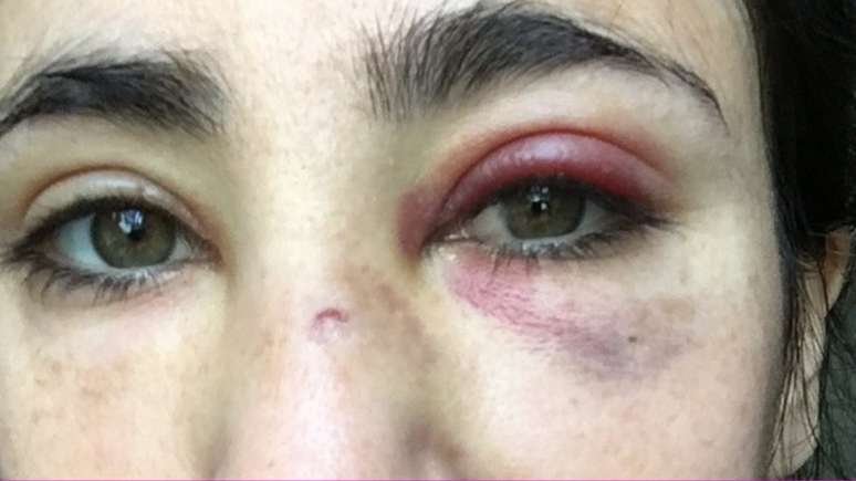 Melania Geymonat disse que nunca tinha sofrido viol&ecirc;ncia f&iacute;sica por causa de sua sexualidade antes