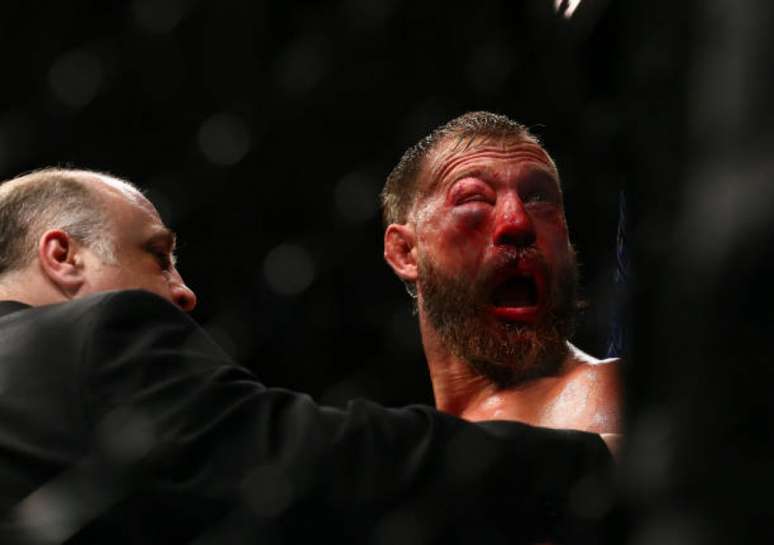 Donald Cerrone foi impedido de continuar na luta por conta de lesão no olho (Foto: Getty Images/UFC)