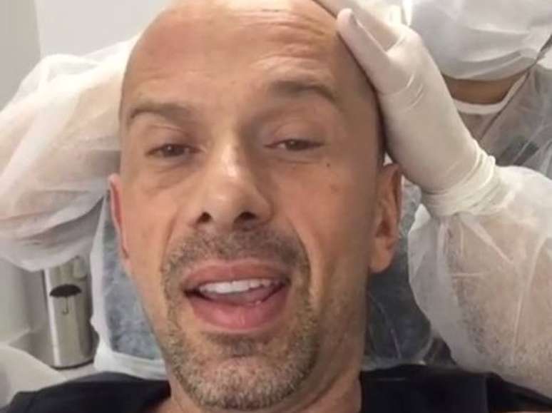 Bruno Diferente faz harmonização facial e compartilha resultado na