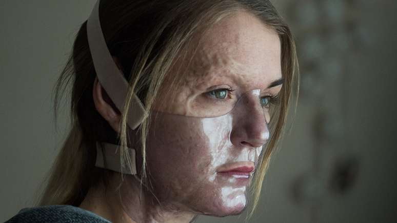 Vicky Knight posing in the film, wearing a clear face mask for her character's facial surgery
