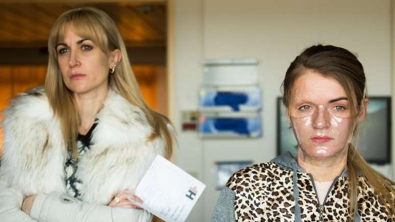 A personagem de Vicky no filme usa uma m&aacute;scara transparente depois de fazer cirurgia no rosto