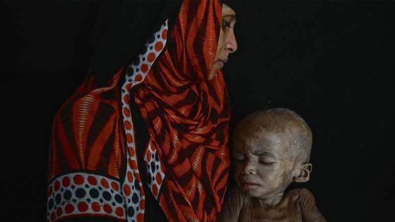 Enquanto imagens de crian&ccedil;as et&iacute;opes desnutridas estamparam jornais durante a d&eacute;cada de 1980, as v&iacute;timas da fome no I&ecirc;men foram amplamente ignoradas