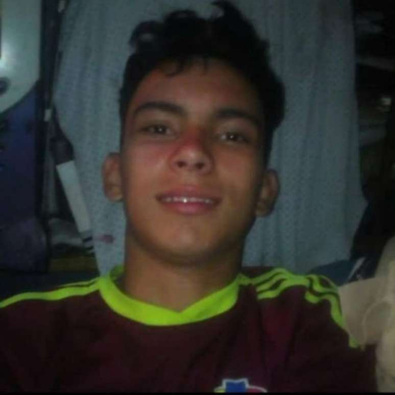 Rufo Antonio Chacón, de 16 anos, ficou cego após ser baleado em protesto na Venezuela