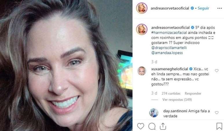 Xuxa comenta harmonização facial de Andrea Sorvetão em post no Instagram.