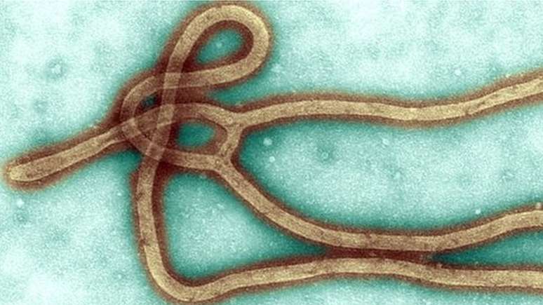 Pacientes com ebola tendem a morrer de desidratação e falência múltipla de órgãos