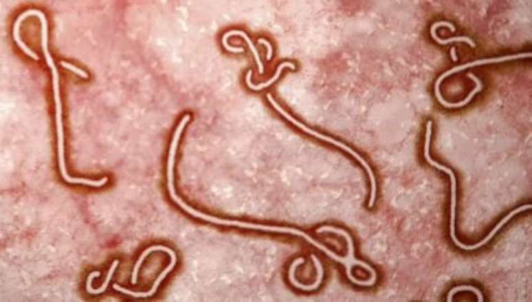 OMS declara ebola emergência internacional - Foto: Shutterstock