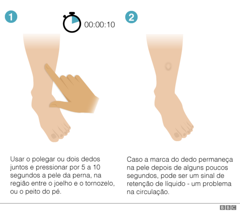 Ilustração mostra movimentos que devem ser feitos no teste de sinal de cacifo