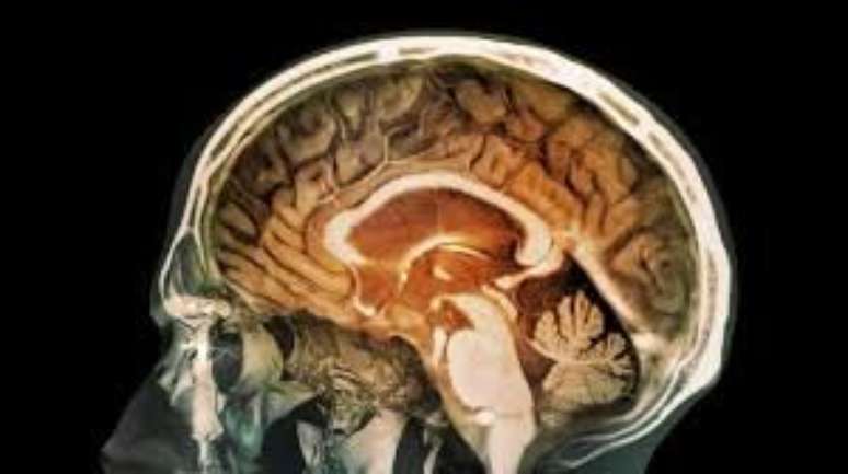 Ci&ecirc;ncia ainda n&atilde;o conseguiu decifrar o funcionamento do c&eacute;rebro