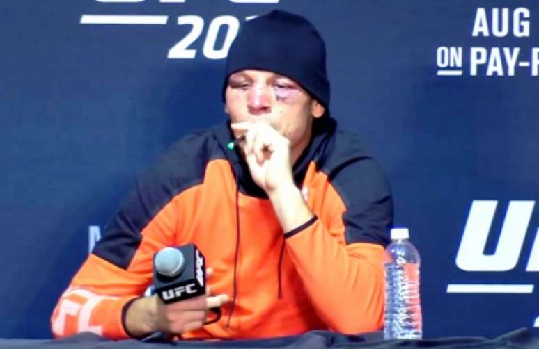 Nate Diaz já fez uso do cigarro de maconha em outras atividades do Ultimate (Foto: Reprodução)