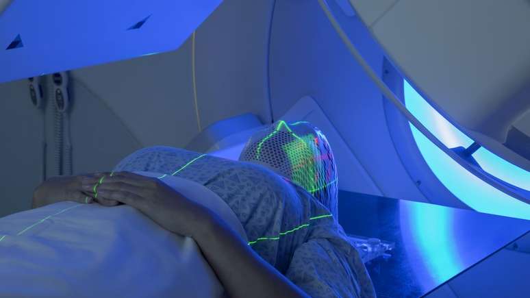 Radioterapia também traz novidades, com técnicas mais eficazes e seguras