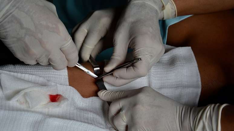 M&atilde;os de cirugi&atilde;o, as mesmas que salvaram a vida da manicure na cr&ocirc;nica 'Fazendo as Unhas'