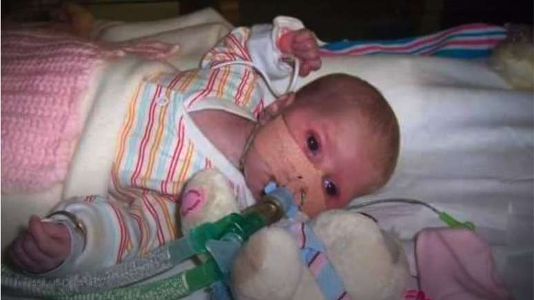 Lilly passou os primeiros três meses de vida no hospital