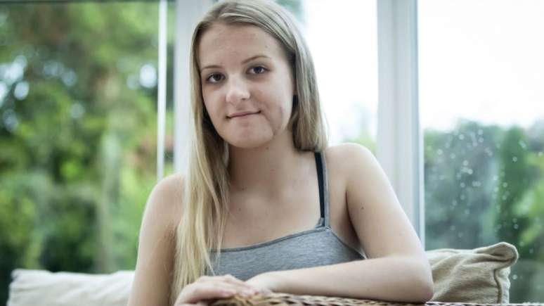 'No come&ccedil;o eu n&atilde;o sabia muito o que fazer, n&atilde;o queria olhar para o meu rosto', diz a garota de 15 anos