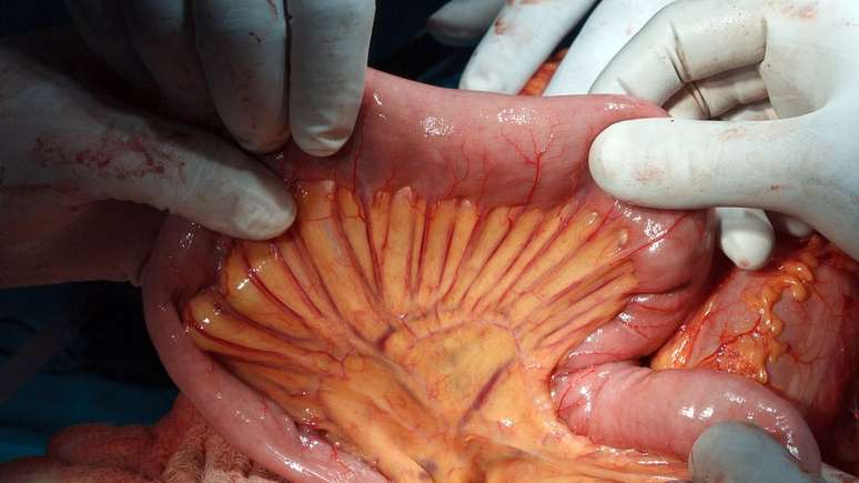 O mesentério é uma dobra dupla do peritônio que une o intestino com a parede do abdômen e permite que ele se mantenha no lugar